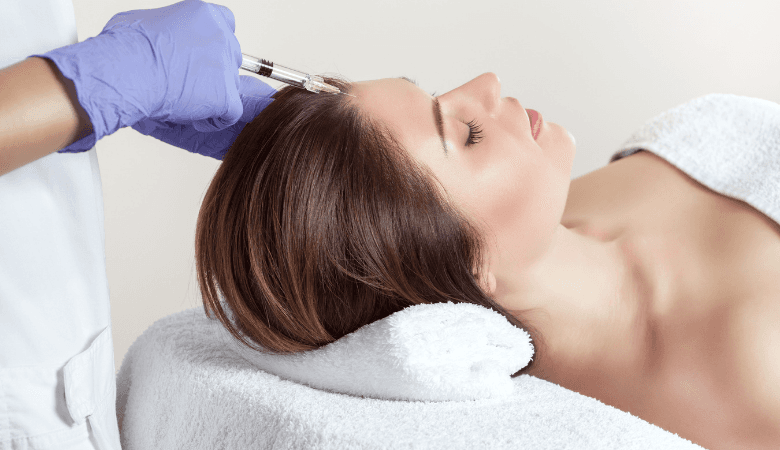 Mesoterapia hiustenlähtöön | -72 % | Tampere - Mesoterapia hiustenlähtöön