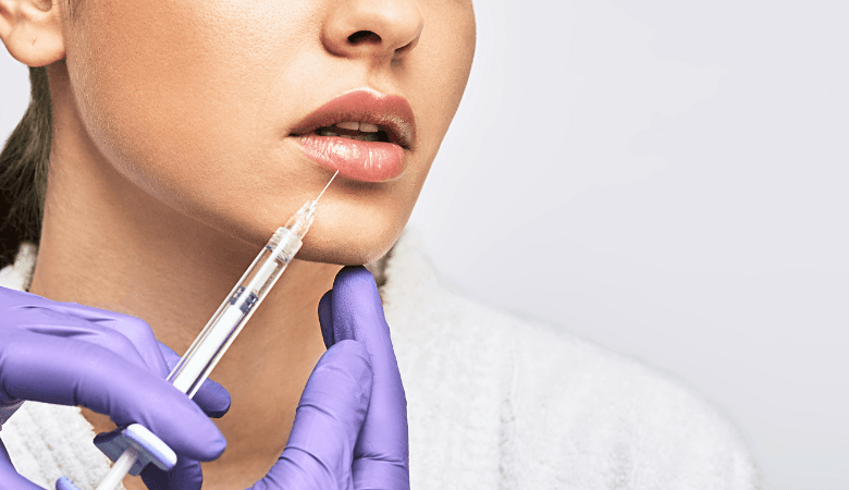 Huulten muotoilu täyteaineella | -50 % | Tampere, Pyynikinrinne - Huulten muotoilu täyteaineella