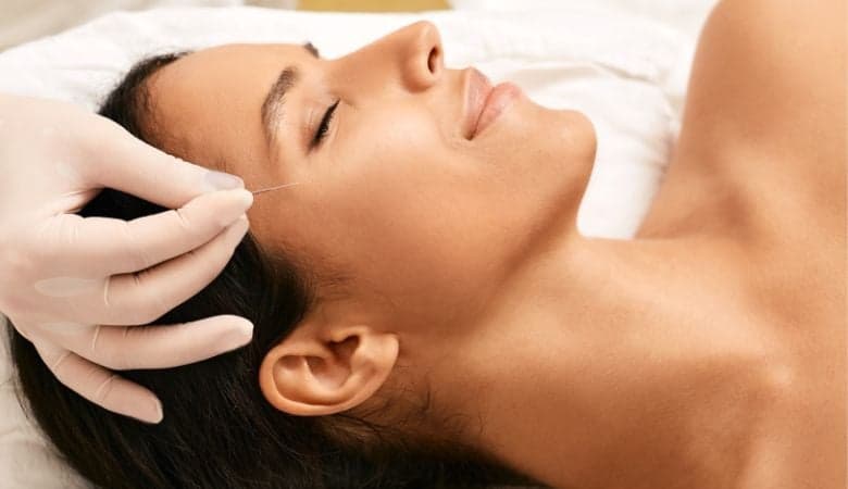 Akupunktio (TCM) niska-,hartia-ja selkäkipujen hoitoon tai kosmeettinen akupunktio | jopa -35 % | Helsinki, Munkkiniemi - Akupunktio (TCM) 60min