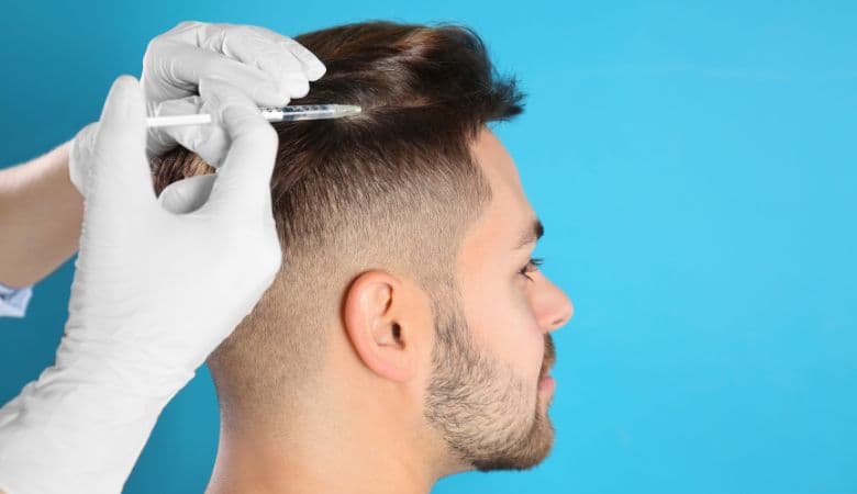 Mesoterapia injektiohoito hiustenlähtöön sairaanhoitajan tekemänä | jopa -75 % | Helsinki - Mesoterapia injektiohoito hiustenlähtöön,